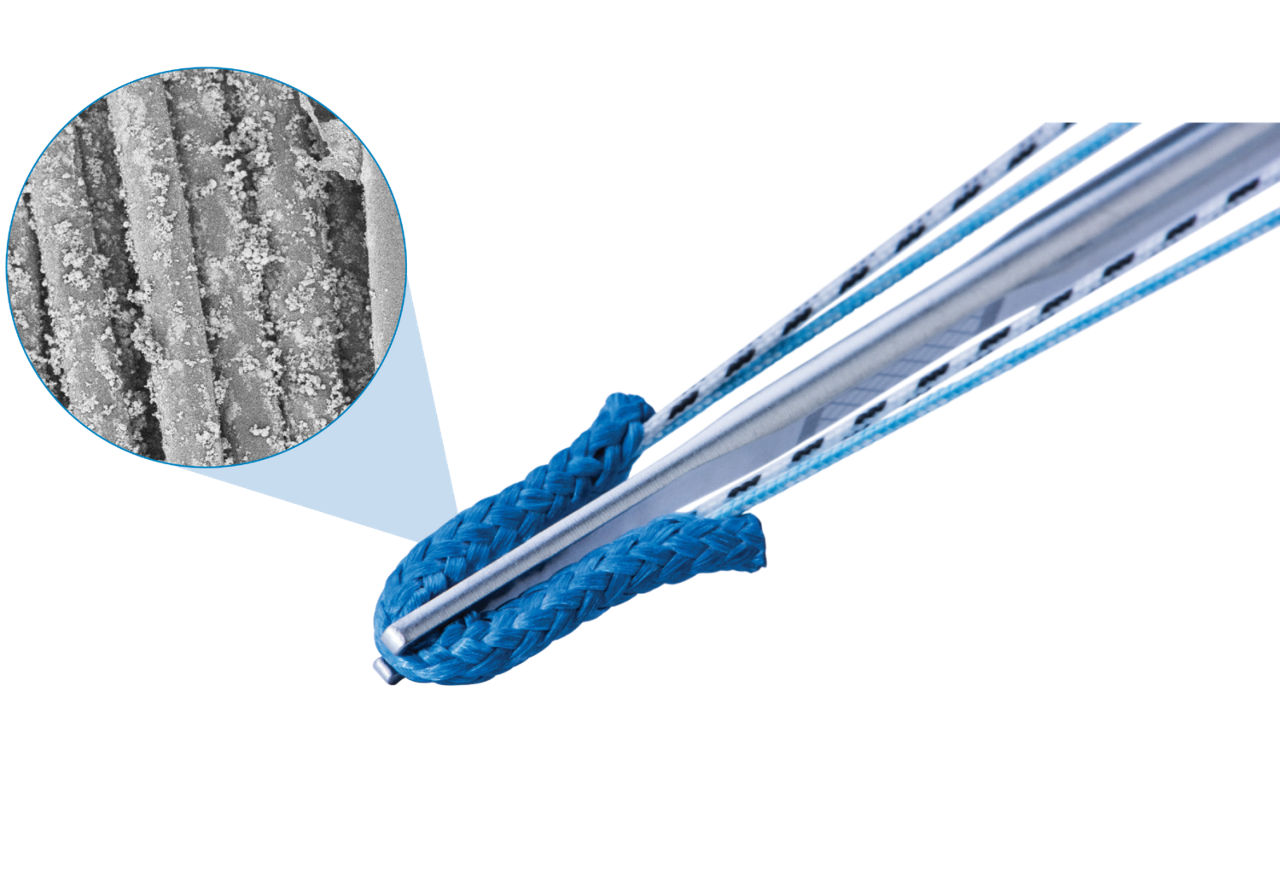 Zimmer Biomet's OsseoCoat™ JuggerKnot® All-Suture Anchors for Soft Tissue Repair