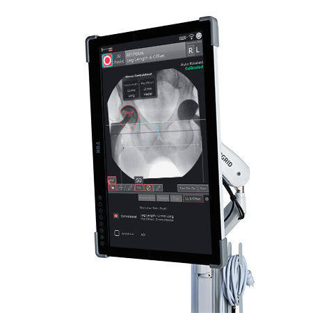 Service Solutions from Zimmer Biomet