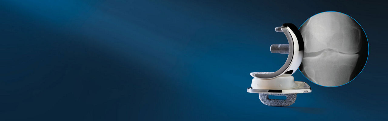 Oxford® Cementless Partial Knee from Zimmer Biomet