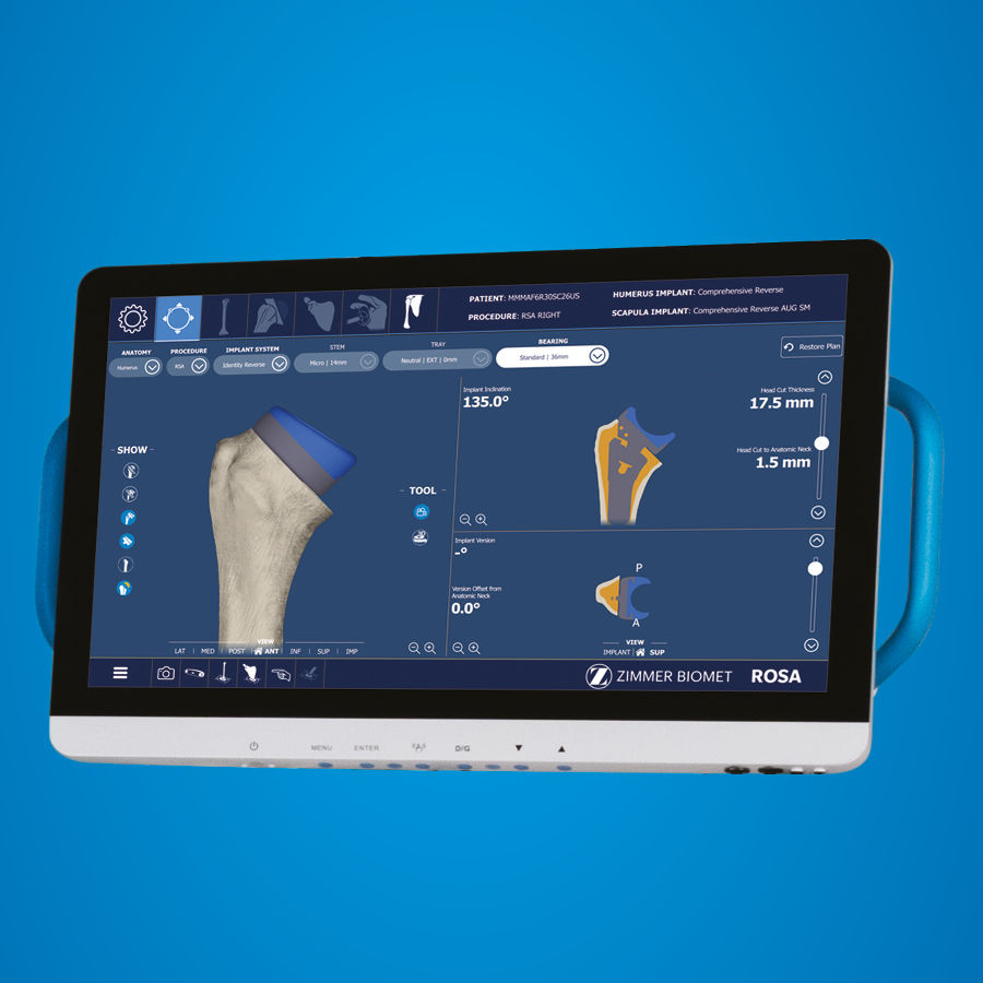 ROSA Shoulder from Zimmer Biomet