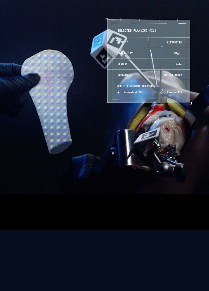 Signature Vision from Zimmer Biomet