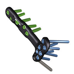 Zimmer Biomet's Trauma Solutions