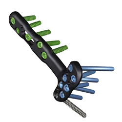 Zimmer Biomet's Trauma Solutions